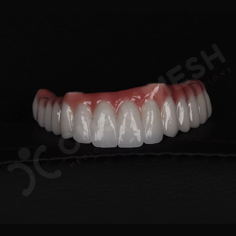 custimesh-custimplant-subperiosteal-vaka1-12