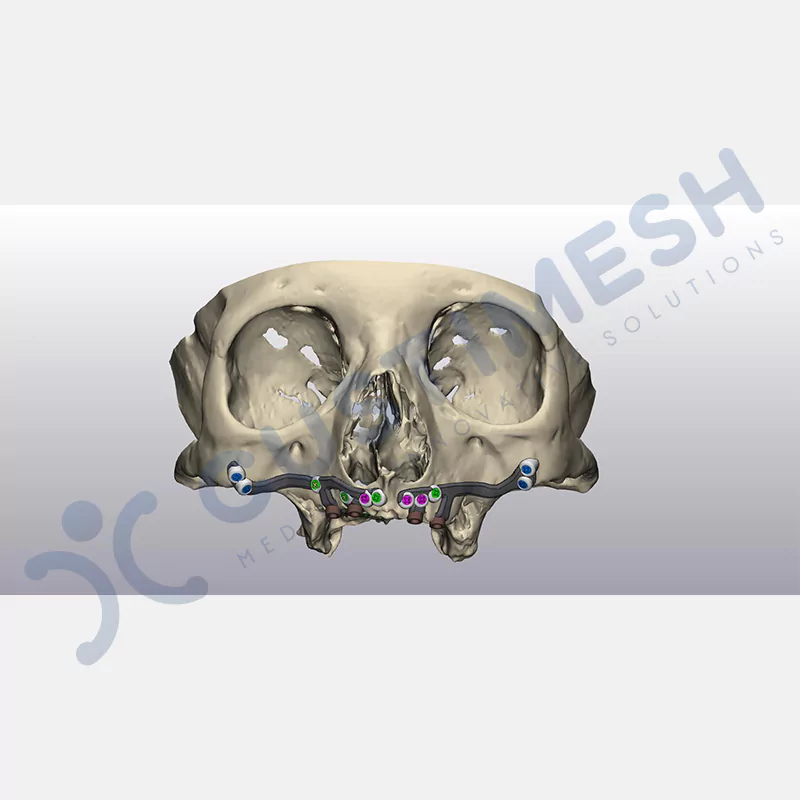 custimesh-custimplant-subperiosteal-vaka3-4