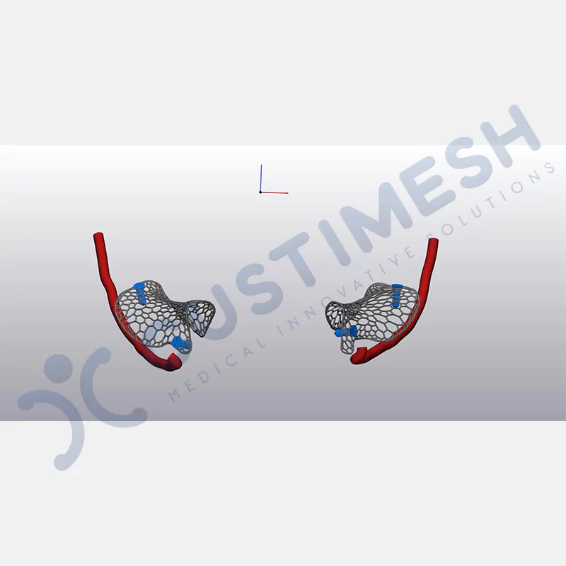 custimesh-mesh-titaniummesh-vaka1-14