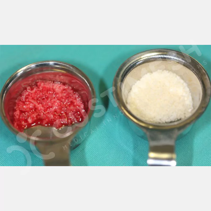 custimesh-mesh-titaniummesh-vaka1-17