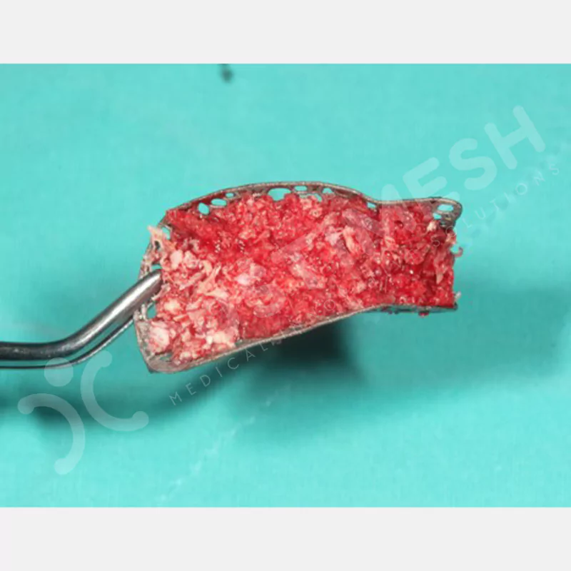 custimesh-mesh-titaniummesh-vaka1-18