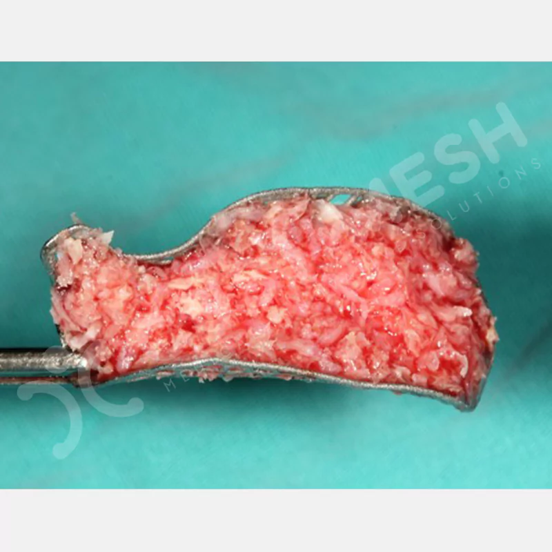 custimesh-mesh-titaniummesh-vaka1-23