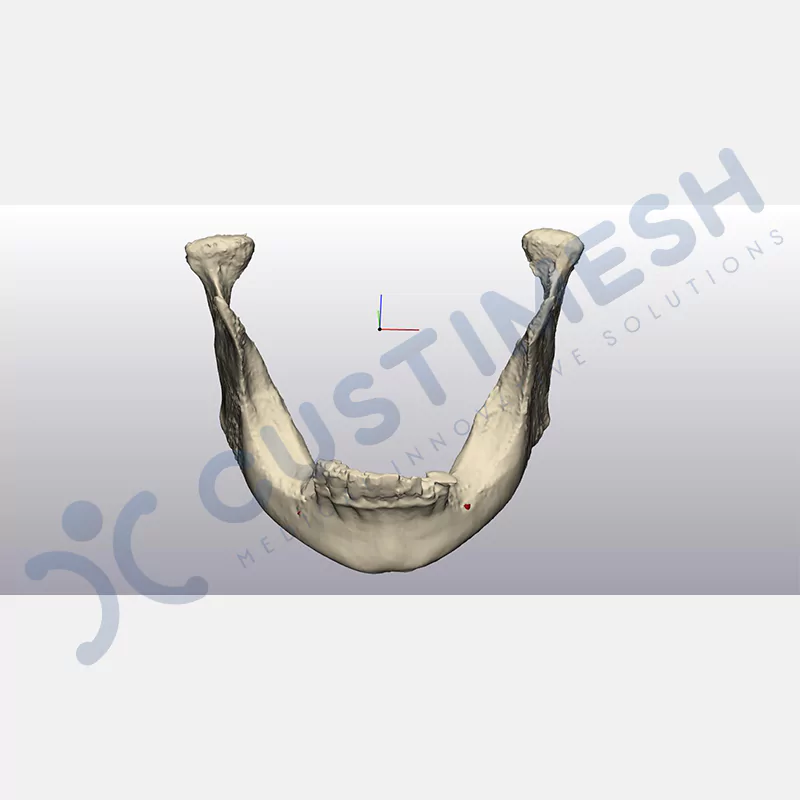 custimesh-mesh-titaniummesh-vaka1-6