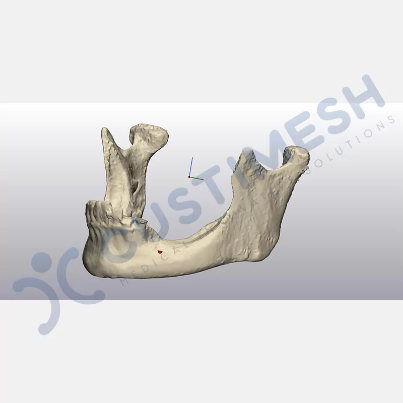 custimesh-mesh-titaniummesh-vaka1-7