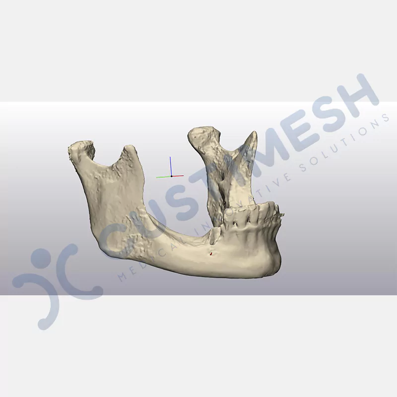 custimesh-mesh-titaniummesh-vaka1-9