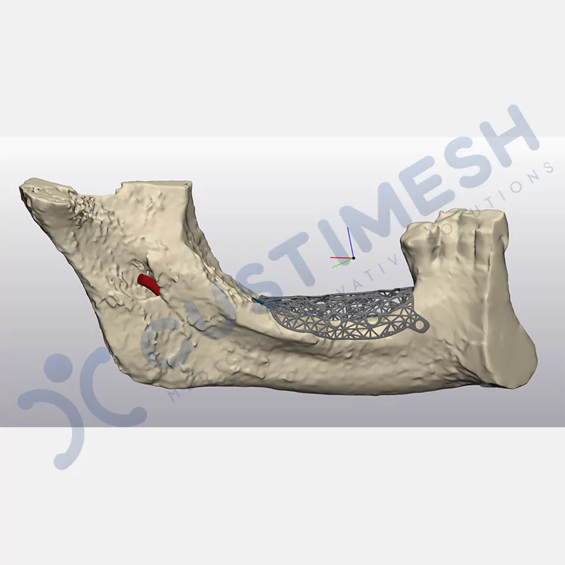 custimesh-mesh-titaniummesh-vaka2-4