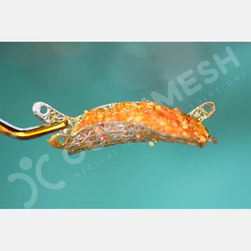 custimesh-mesh-titaniummesh-vaka2-9