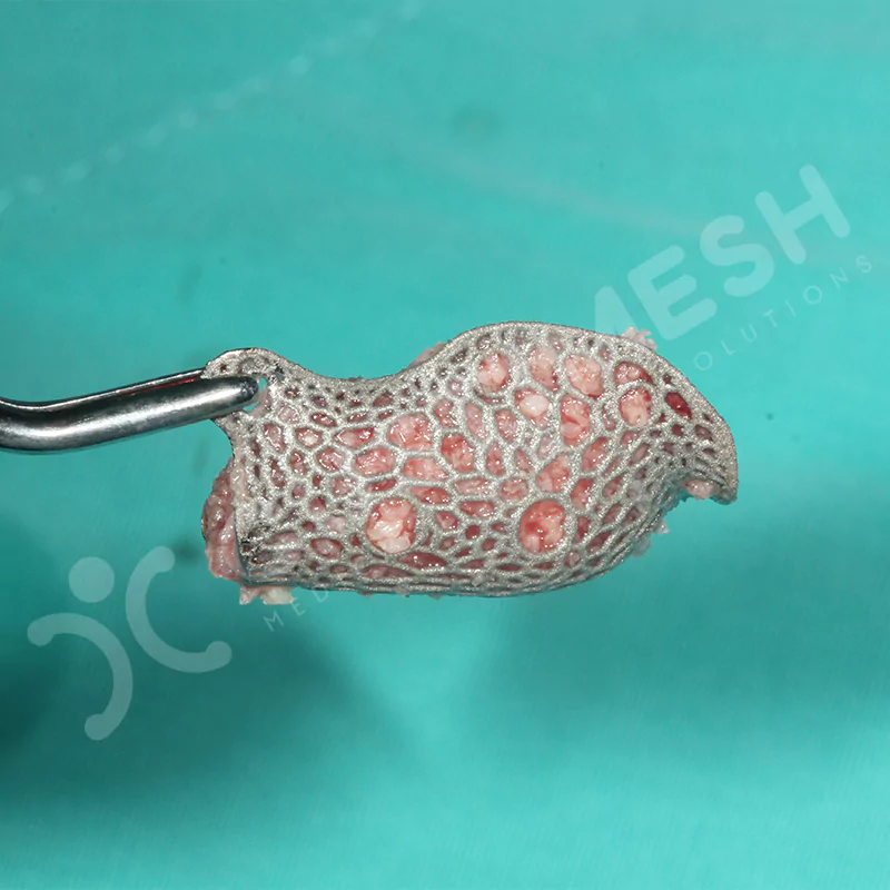 custimesh-mesh-titaniummesh-vaka3-16