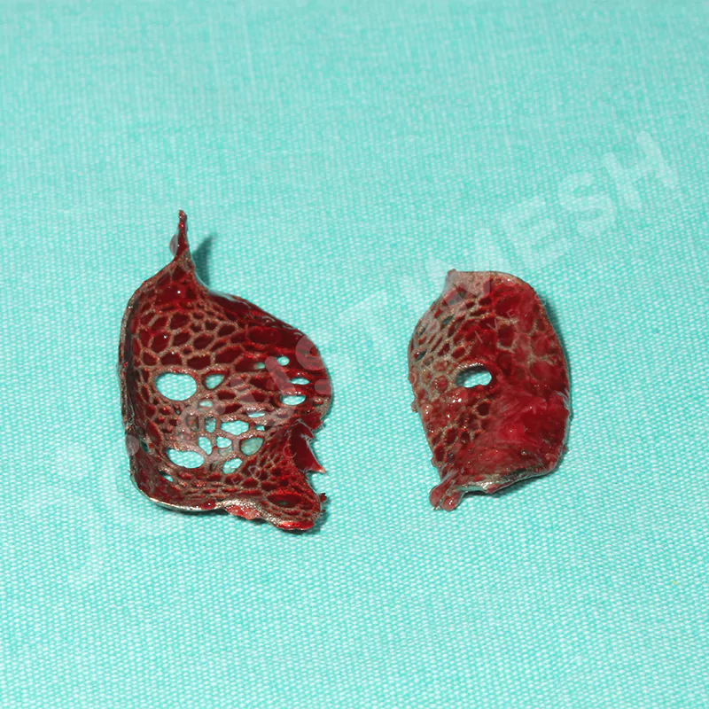 custimesh-mesh-titaniummesh-vaka3-23