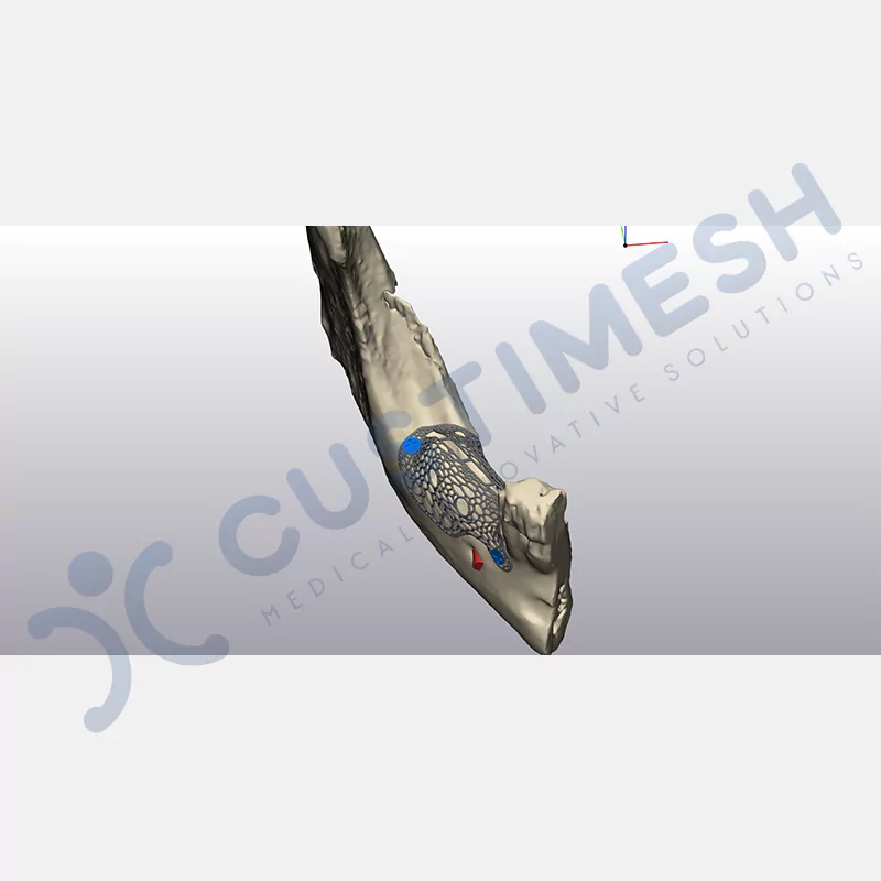 custimesh-mesh-titaniummesh-vaka3-5